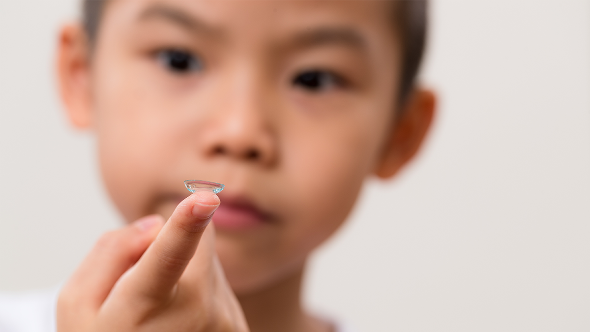 Soft contact lenses for myopia control in children
