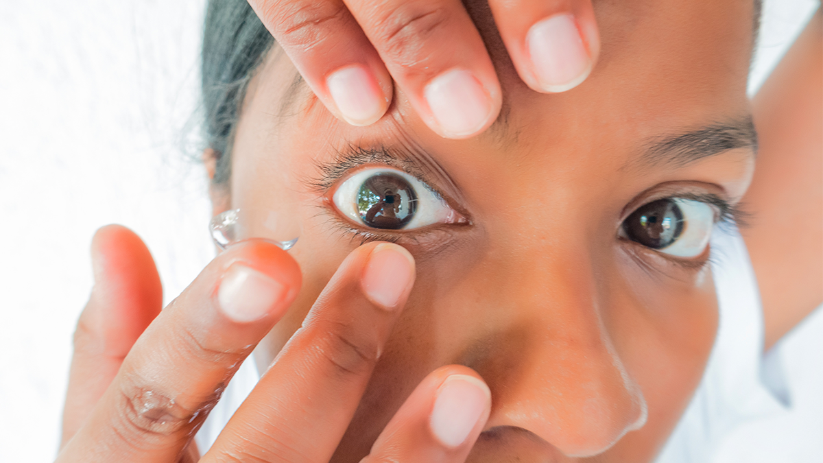 Soft contact lenses for myopia control in teenagers