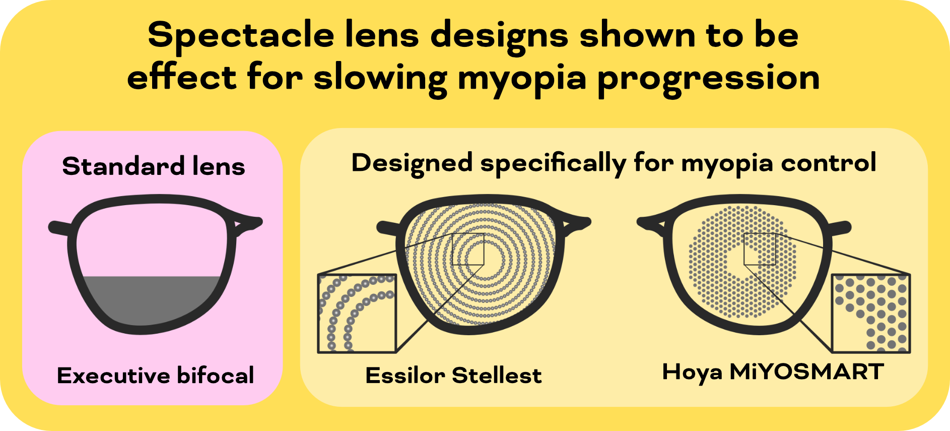 How do glasses store correct nearsightedness