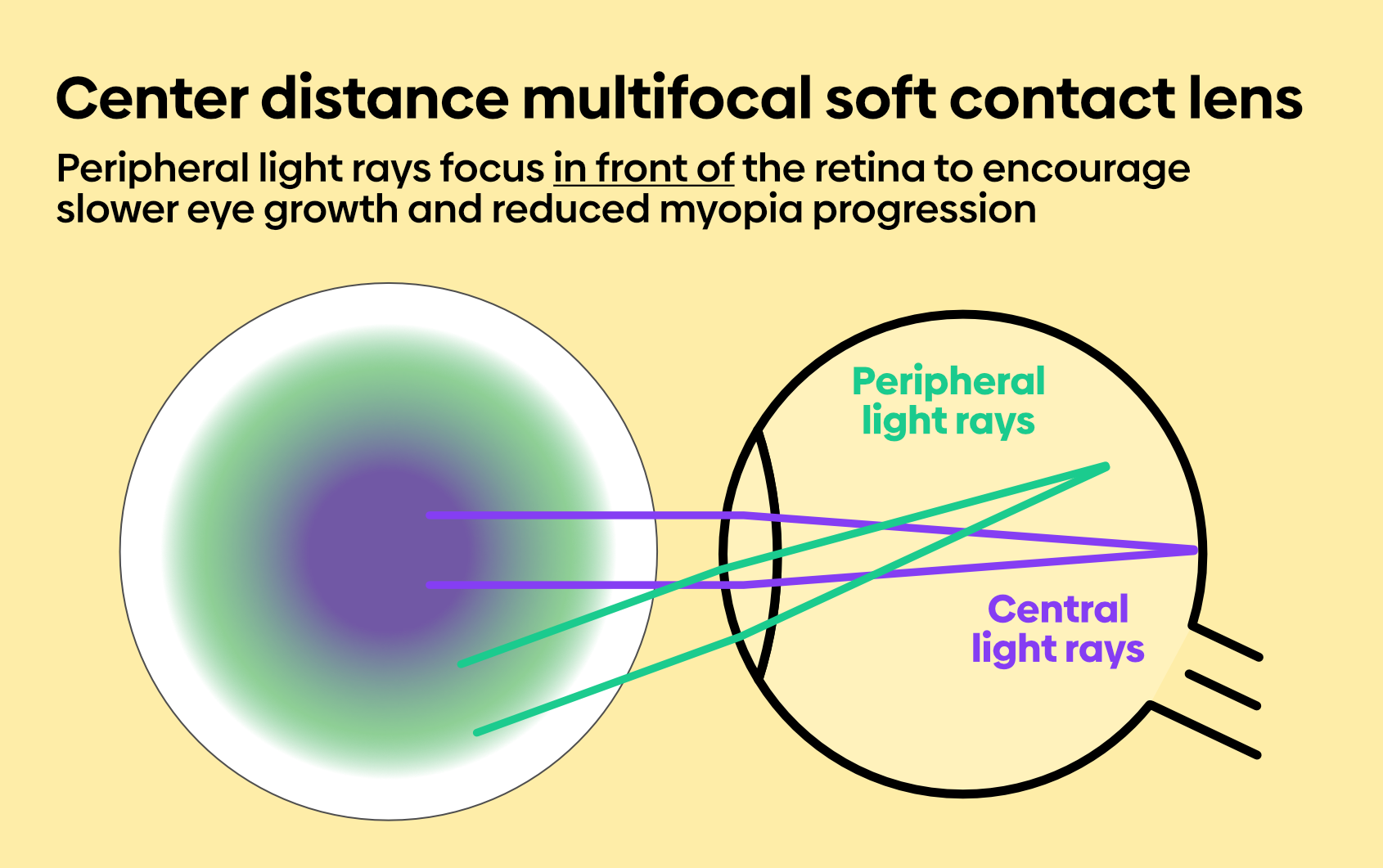 Contact Lenses For Short Sighted And Reading | informacionpublica.svet ...