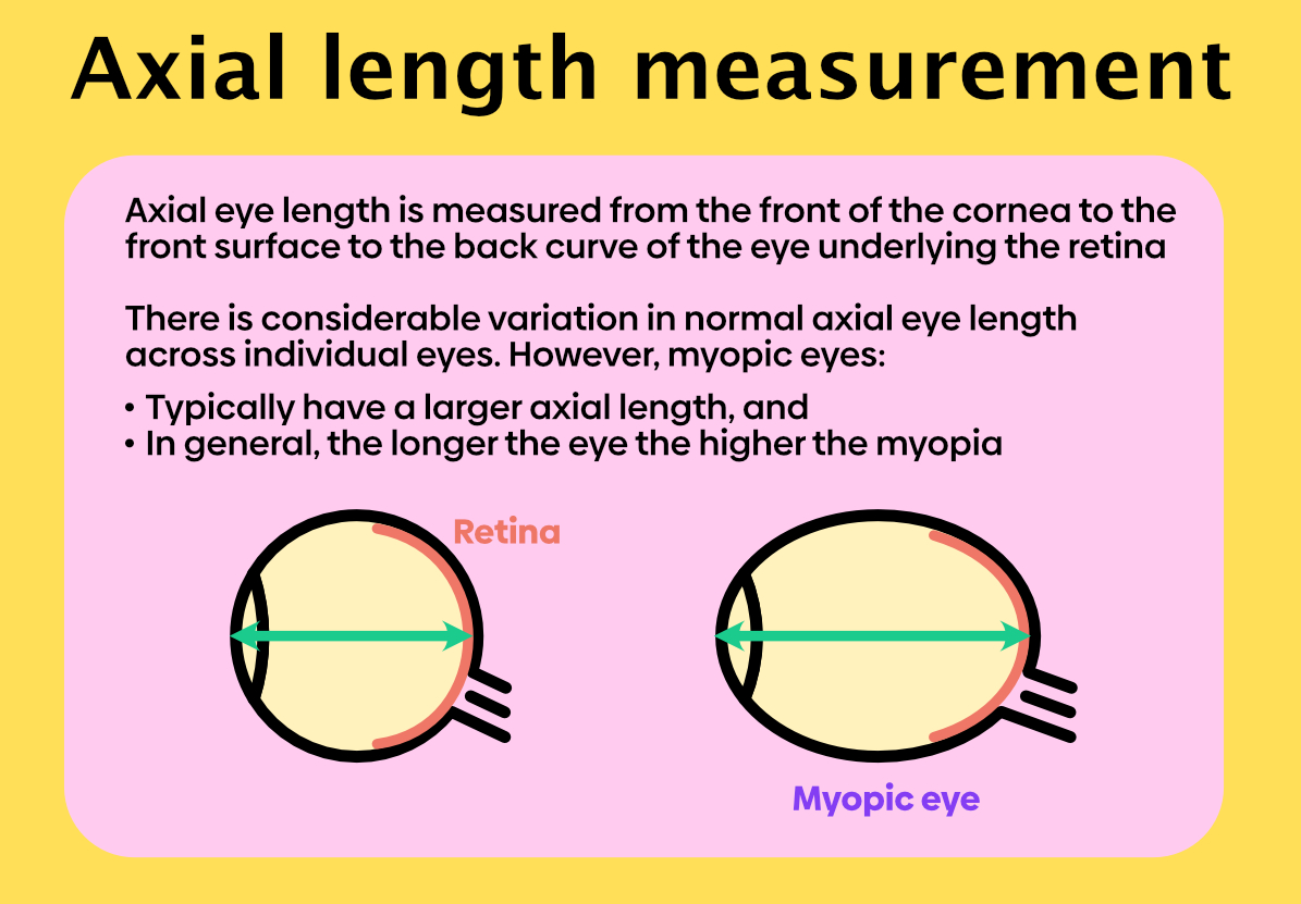 Measuring myopia progression using axial eye length My Kids Vision